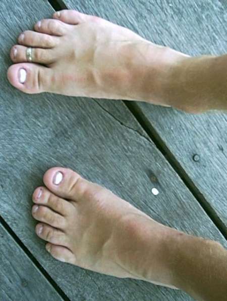  pour Jf aux ongles rongés